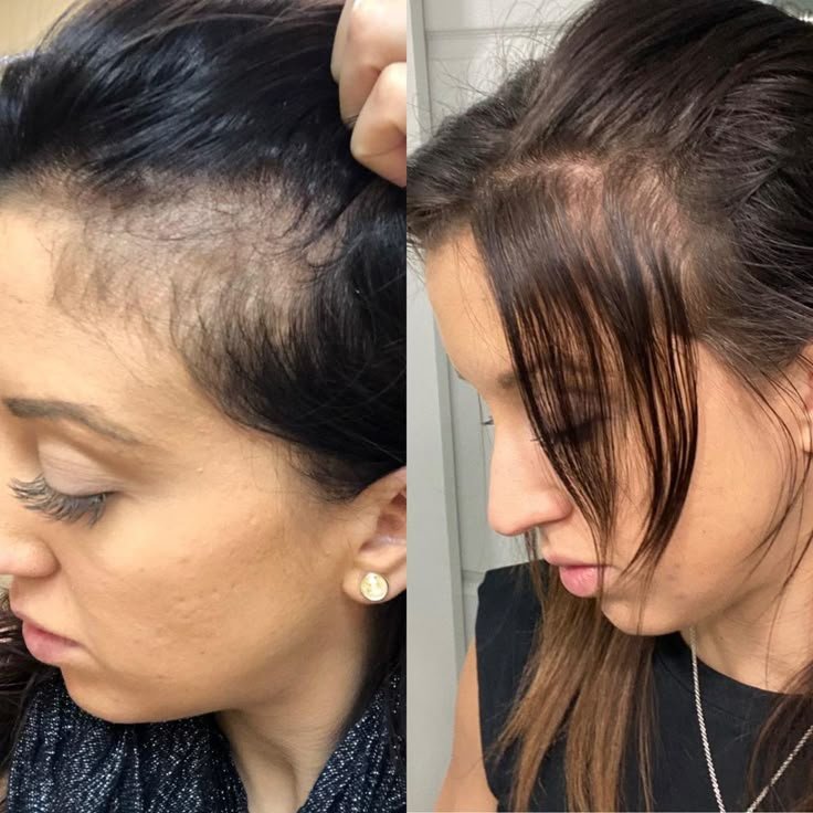 Depoimento de Ana P.